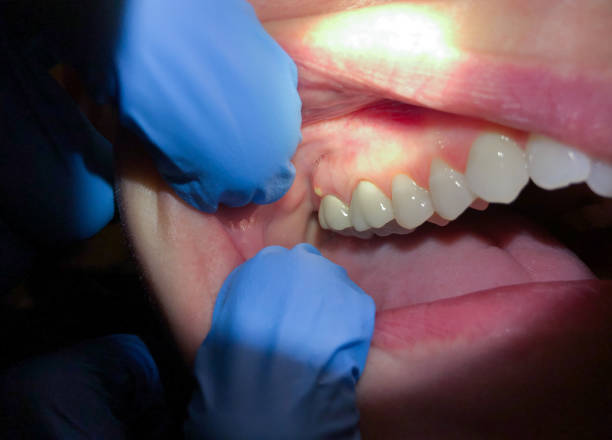 Best Emergency Denture Repair in Carrollton, VA