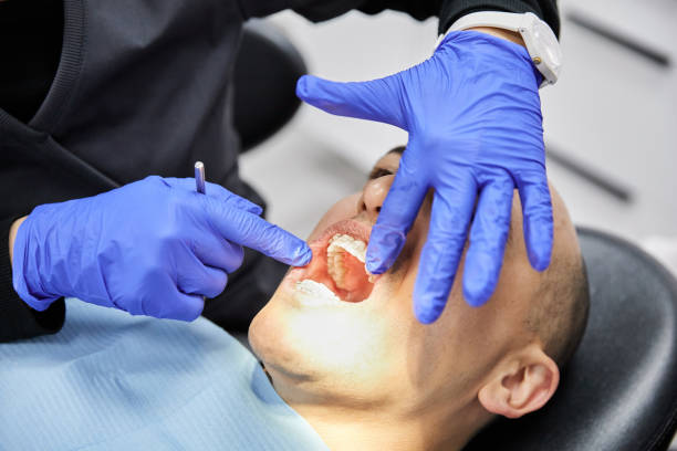 Best Emergency Wisdom Teeth Removal in Carrollton, VA