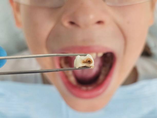 Best Pediatric Emergency Dentist in Carrollton, VA